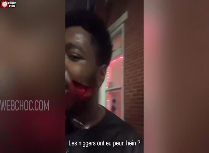 Video :Instead of going to the hospital, he performs a live concert to flaunt his knife-cut face (informed public)
